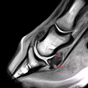 Le pied - IRM Cheval