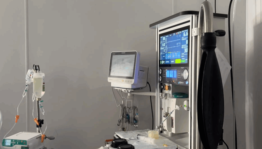 ECG